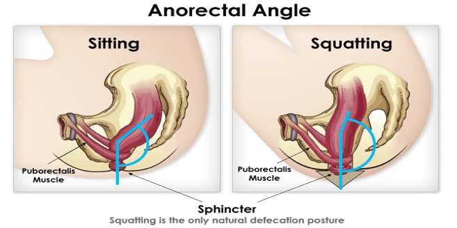 Good Bowel Habits - Angle of Approach